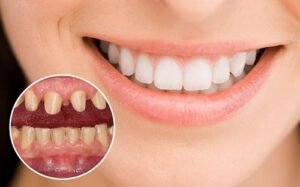 Quy trình làm răng thẩm mỹ an toàn và chuyên nghiệp